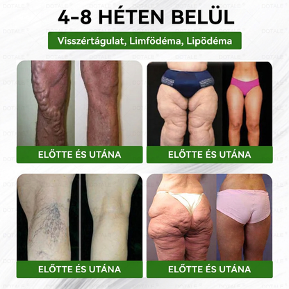 DOTALE Metabolic Nano Microneedle Patch